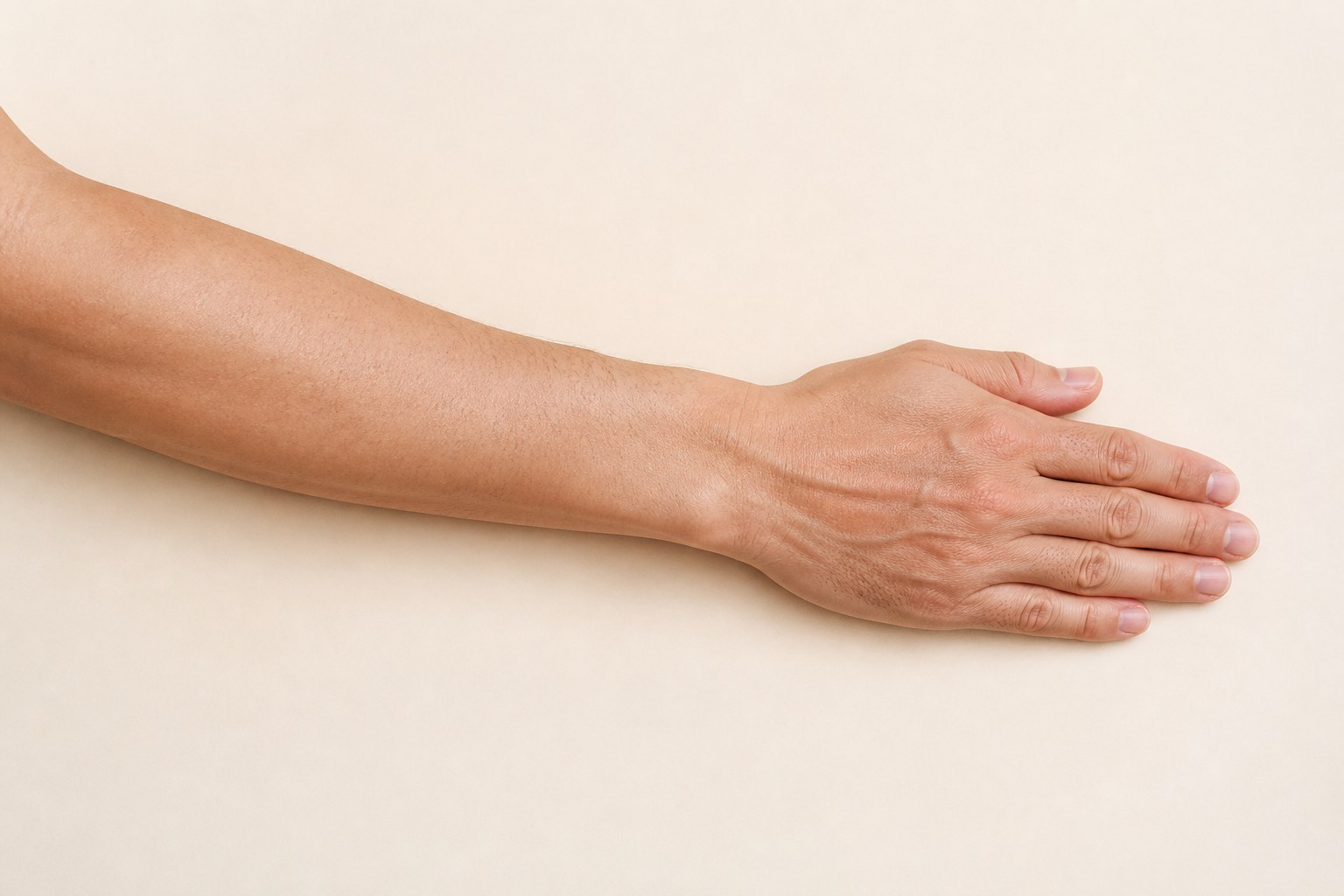Dorsal forearm used to locate TE 5